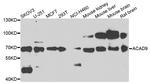 ACAD9 Antibody in Western Blot (WB)