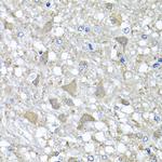 VPS37A Antibody in Immunohistochemistry (Paraffin) (IHC (P))