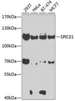 SPICE1 Antibody in Western Blot (WB)