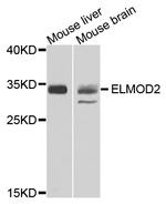 ELMOD2 Antibody in Western Blot (WB)