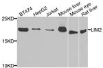 LIM2 Antibody in Western Blot (WB)