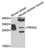 Trypsin 2 Antibody in Western Blot (WB)