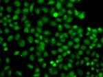 PIP5K1A Antibody in Immunocytochemistry (ICC/IF)