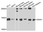 SSNA1 Antibody in Western Blot (WB)