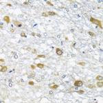 DDX39 Antibody in Immunohistochemistry (Paraffin) (IHC (P))