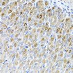 MTX2 Antibody in Immunohistochemistry (Paraffin) (IHC (P))