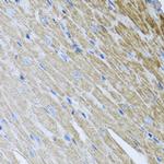 MTX2 Antibody in Immunohistochemistry (Paraffin) (IHC (P))