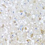 EFHC1 Antibody in Immunohistochemistry (Paraffin) (IHC (P))