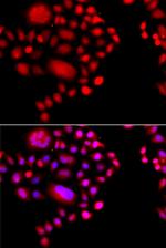 POLR1D Antibody in Immunocytochemistry (ICC/IF)