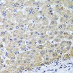 OSGEPL1 Antibody in Immunohistochemistry (Paraffin) (IHC (P))