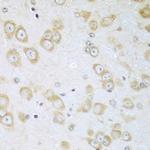 ACOX1 Antibody in Immunohistochemistry (Paraffin) (IHC (P))