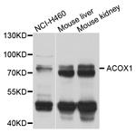 ACOX1 Antibody in Western Blot (WB)