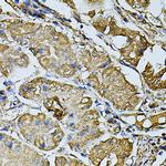 K-cadherin Antibody in Immunohistochemistry (Paraffin) (IHC (P))