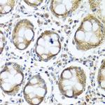 IFI44 Antibody in Immunohistochemistry (Paraffin) (IHC (P))