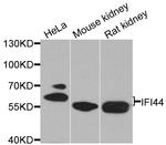 IFI44 Antibody in Western Blot (WB)