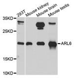 ARL6 Antibody in Western Blot (WB)