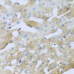 AP1M2 Antibody in Immunohistochemistry (Paraffin) (IHC (P))