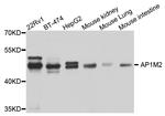 AP1M2 Antibody in Western Blot (WB)