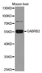 GABRB2 Antibody in Western Blot (WB)