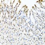 YTHDF3 Antibody in Immunohistochemistry (Paraffin) (IHC (P))