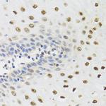 YTHDF3 Antibody in Immunohistochemistry (Paraffin) (IHC (P))