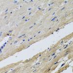 FECH Antibody in Immunohistochemistry (Paraffin) (IHC (P))