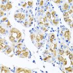 FECH Antibody in Immunohistochemistry (Paraffin) (IHC (P))