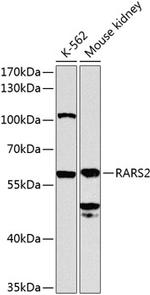 RARS2 Antibody in Western Blot (WB)