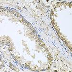 CYP46A1 Antibody in Immunohistochemistry (Paraffin) (IHC (P))