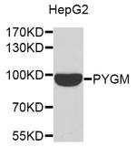 PYGM Antibody in Western Blot (WB)