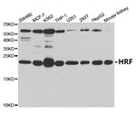 TPT1 Antibody in Western Blot (WB)