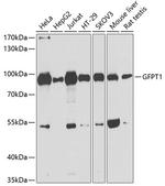 GFPT1 Antibody in Western Blot (WB)