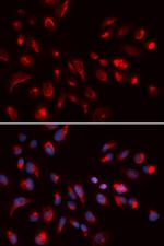 CHRM5 Antibody in Immunocytochemistry (ICC/IF)