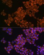 SQLE Antibody in Immunocytochemistry (ICC/IF)