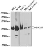 MCM5 Antibody in Western Blot (WB)