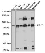 KCNV2 Antibody in Western Blot (WB)