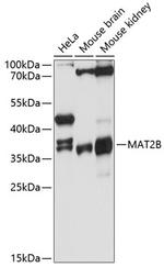 MAT2B Antibody in Western Blot (WB)