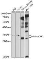 MMACHC Antibody in Western Blot (WB)