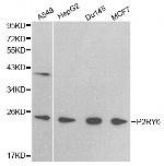 P2Y6 Antibody in Western Blot (WB)