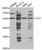 tPA Antibody in Western Blot (WB)