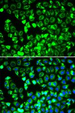 DLD Antibody in Immunocytochemistry (ICC/IF)