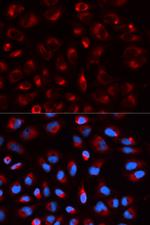 DLD Antibody in Immunocytochemistry (ICC/IF)