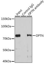 Optineurin Antibody in Immunoprecipitation (IP)