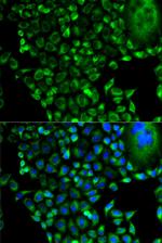 PSMD10 Antibody in Immunocytochemistry (ICC/IF)