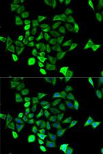 KCNN4 Antibody in Immunocytochemistry (ICC/IF)