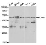 KCNN4 Antibody in Western Blot (WB)