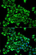 CDA Antibody in Immunocytochemistry (ICC/IF)