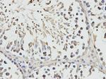 RPS3 Antibody in Immunohistochemistry (Paraffin) (IHC (P))