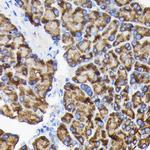 RPS3 Antibody in Immunohistochemistry (Paraffin) (IHC (P))