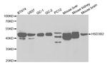 HSD3B2 Antibody in Western Blot (WB)